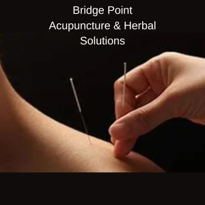 Bridge Point Acupuncture portland oregon